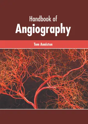 Manuel d'angiographie - Handbook of Angiography