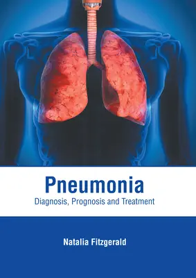 Pneumonie : Diagnostic, pronostic et traitement - Pneumonia: Diagnosis, Prognosis and Treatment