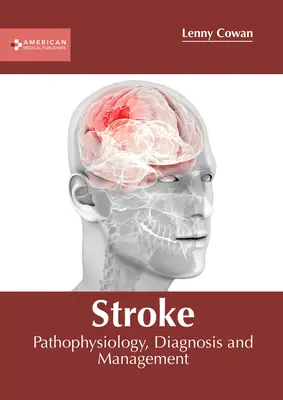 Accident vasculaire cérébral : Physiopathologie, diagnostic et prise en charge - Stroke: Pathophysiology, Diagnosis and Management