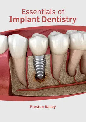 L'essentiel de la dentisterie implantaire - Essentials of Implant Dentistry