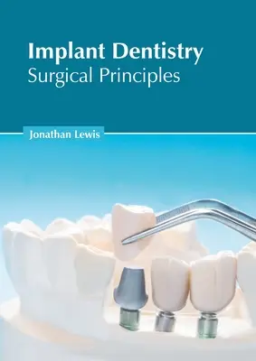 La dentisterie implantaire : Principes chirurgicaux - Implant Dentistry: Surgical Principles