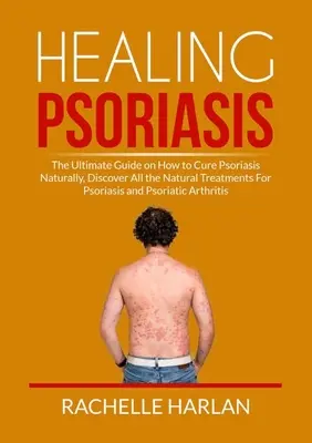 La guérison du psoriasis : Le guide ultime sur la façon de guérir le psoriasis naturellement, découvrez tous les traitements naturels pour le psoriasis et le psoriasis. - Healing Psoriasis: The Ultimate Guide on How to Cure Psoriasis Naturally, Discover All the Natural Treatments For Psoriasis and Psoriatic