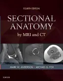 Anatomie en coupe par IRM et CT - Sectional Anatomy by MRI and CT