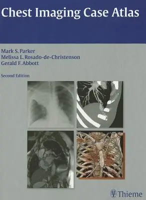 Atlas de cas d'imagerie thoracique - Chest Imaging Case Atlas