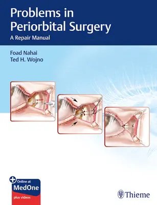 Problèmes de chirurgie périorbitaire : Un manuel de réparation - Problems in Periorbital Surgery: A Repair Manual