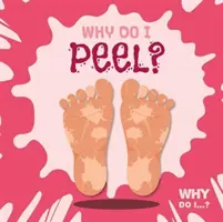 Pourquoi je pèle ? - Why Do I Peel?