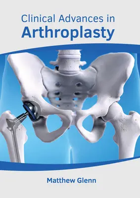 Avancées cliniques en matière d'arthroplastie - Clinical Advances in Arthroplasty