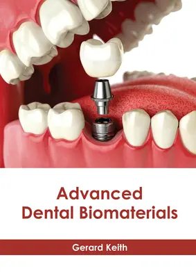 Biomatériaux dentaires avancés - Advanced Dental Biomaterials