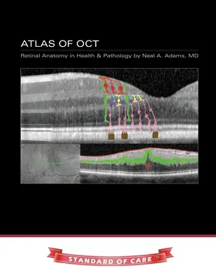 Atlas de l'OCT : Anatomie rétinienne en santé et en pathologie - Atlas of OCT: Retinal Anatomy in Health & Pathology