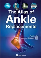 L'Atlas des prothèses de cheville - The Atlas of Ankle Replacements