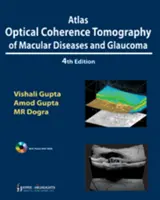 Atlas de la tomographie en cohérence optique des maladies maculaires et du glaucome - Atlas Optical Coherence Tomography of Macular Diseases and Glaucoma