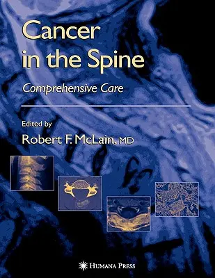 Cancer de la colonne vertébrale : Soins complets - Cancer in the Spine: Comprehensive Care