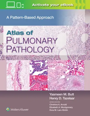 Atlas de pathologie pulmonaire : Une approche basée sur les modèles - Atlas of Pulmonary Pathology: A Pattern Based Approach