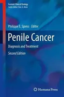 Le cancer du pénis : Diagnostic et traitement - Penile Cancer: Diagnosis and Treatment