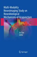 Étude de neuro-imagerie multi-modalités sur les mécanismes neurobiologiques de l'acupuncture - Multi-Modality Neuroimaging Study on Neurobiological Mechanisms of Acupuncture