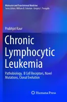 Leucémie lymphoïde chronique : Pathobiologie, récepteurs des cellules B, nouvelles mutations, évolution clonale - Chronic Lymphocytic Leukemia: Pathobiology, B Cell Receptors, Novel Mutations, Clonal Evolution
