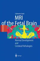 IRM du cerveau fœtal : Développement normal et pathologies cérébrales - MRI of the Fetal Brain: Normal Development and Cerebral Pathologies