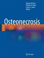 Ostéonécrose - Osteonecrosis