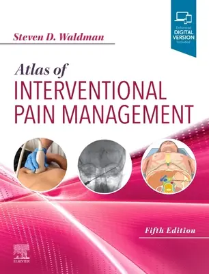 Atlas de la gestion interventionnelle de la douleur - Atlas of Interventional Pain Management