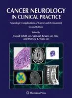 Neurologie du cancer en pratique clinique : Complications neurologiques du cancer et son traitement - Cancer Neurology in Clinical Practice: Neurologic Complications of Cancer and Its Treatment