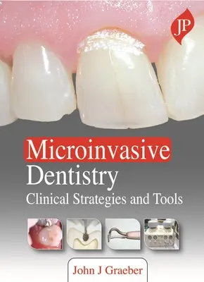 Dentisterie micro-invasive - Stratégies et outils cliniques - Microinvasive Dentistry - Clinical Strategies and Tools