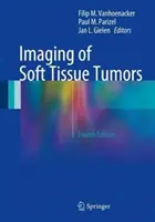 Imagerie des tumeurs des tissus mous - Imaging of Soft Tissue Tumors