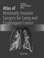 Atlas de la chirurgie mini-invasive pour le cancer du poumon et de l'œsophage - Atlas of Minimally Invasive Surgery for Lung and Esophageal Cancer