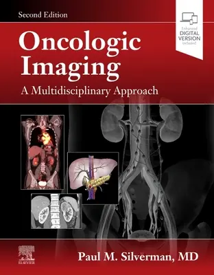 L'imagerie oncologique : Une approche multidisciplinaire - Oncologic Imaging: A Multidisciplinary Approach
