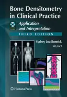 Densitométrie osseuse en pratique clinique : Application et interprétation - Bone Densitometry in Clinical Practice: Application and Interpretation