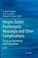 Herpès Zoster : Névralgie post-zostérienne et autres complications : Focus sur le traitement et la prévention - Herpes Zoster: Postherpetic Neuralgia and Other Complications: Focus on Treatment and Prevention