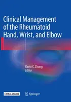 Gestion clinique de la main, du poignet et du coude rhumatoïdes - Clinical Management of the Rheumatoid Hand, Wrist, and Elbow