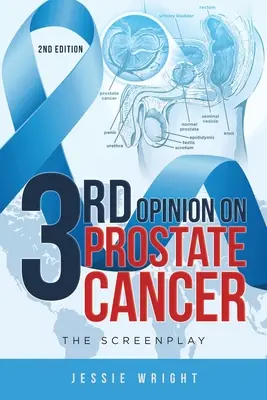 Troisième avis sur le cancer de la prostate : Le scénario - 3rd Opinion on Prostate Cancer: The Screenplay