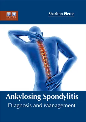 La spondylarthrite ankylosante : Diagnostic et prise en charge - Ankylosing Spondylitis: Diagnosis and Management