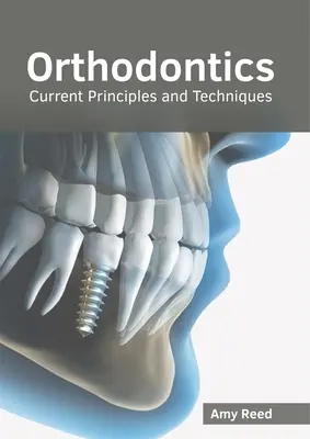 Orthodontie : Principes et techniques actuels - Orthodontics: Current Principles and Techniques