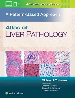 Atlas de la pathologie hépatique : Une approche basée sur les modèles - Atlas of Liver Pathology: A Pattern-Based Approach