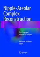 Reconstruction du complexe mamelon-aréole : Principes et techniques cliniques - Nipple-Areolar Complex Reconstruction: Principles and Clinical Techniques