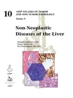 Maladies non néoplasiques du foie - Non-Neoplastic Diseases of the Liver