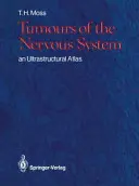 Tumeurs du système nerveux : Atlas ultrastructural - Tumours of the Nervous System: An Ultrastructural Atlas