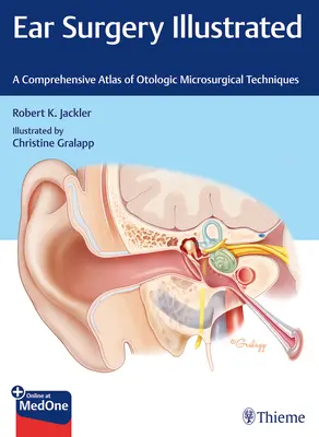 Chirurgie de l'oreille illustrée : Un atlas complet des techniques de microchirurgie otologique - Ear Surgery Illustrated: A Comprehensive Atlas of Otologic Microsurgical Techniques