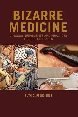 Médecine bizarre : Traitements et pratiques inhabituels à travers les âges - Bizarre Medicine: Unusual Treatments and Practices through the Ages