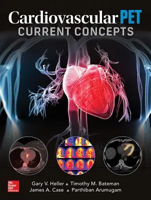 Pet Cardiovascular : Concepts actuels - Cardiovascular Pet: Current Concepts