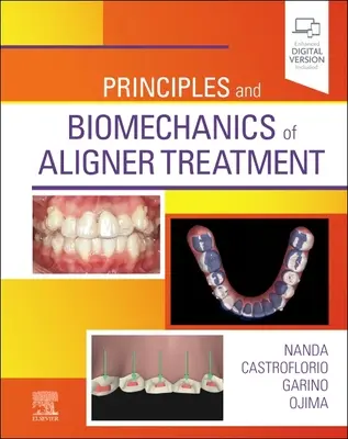 Principes et biomécanique du traitement des aligneurs - Principles and Biomechanics of Aligner Treatment