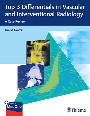 Les trois principales différences en radiologie vasculaire et interventionnelle : Une étude de cas - Top 3 Differentials in Vascular and Interventional Radiology: A Case Review