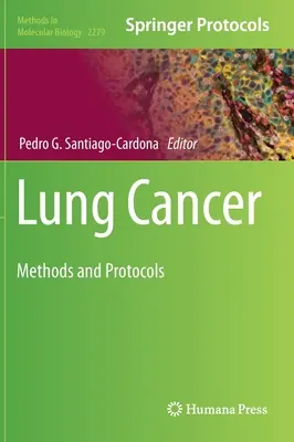 Cancer du poumon : Méthodes et protocoles - Lung Cancer: Methods and Protocols