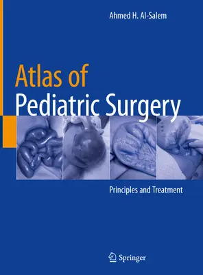Atlas de chirurgie pédiatrique : Principes et traitement - Atlas of Pediatric Surgery: Principles and Treatment