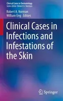 Cas cliniques d'infections et d'infestations de la peau - Clinical Cases in Infections and Infestations of the Skin