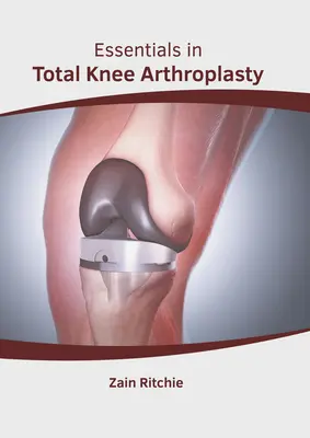 L'essentiel de l'arthroplastie totale du genou - Essentials in Total Knee Arthroplasty