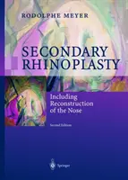 Rhinoplastie secondaire : Y compris la reconstruction du nez - Secondary Rhinoplasty: Including Reconstruction of the Nose