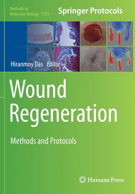 Régénération des plaies : Méthodes et protocoles - Wound Regeneration: Methods and Protocols