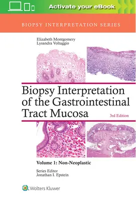 Interprétation de la biopsie de la muqueuse du tractus gastro-intestinal : Volume 1 : Non néoplasique - Biopsy Interpretation of the Gastrointestinal Tract Mucosa: Volume 1: Non-Neoplastic